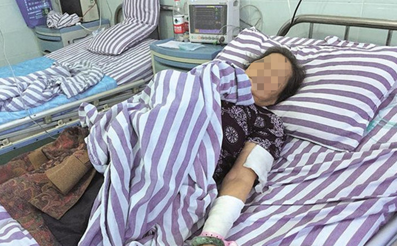 认定原告黄桂招依次构成一处一级伤残、一处四级伤残、一处十级伤残