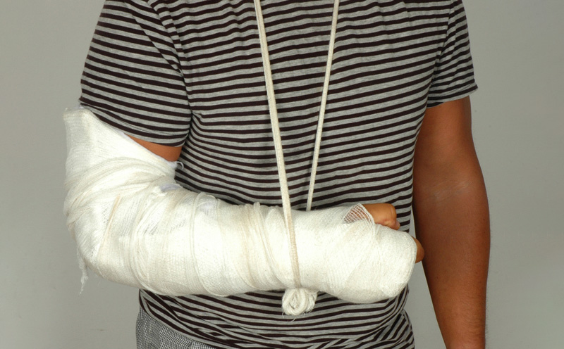 断手也是交通事故人身伤害中比较常见的现象